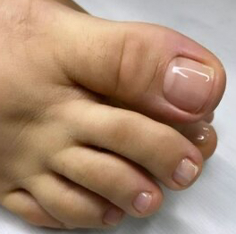 обработка пальчиков с покрытием бесцветным лаком