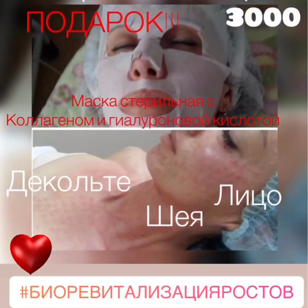 Биоревитализация