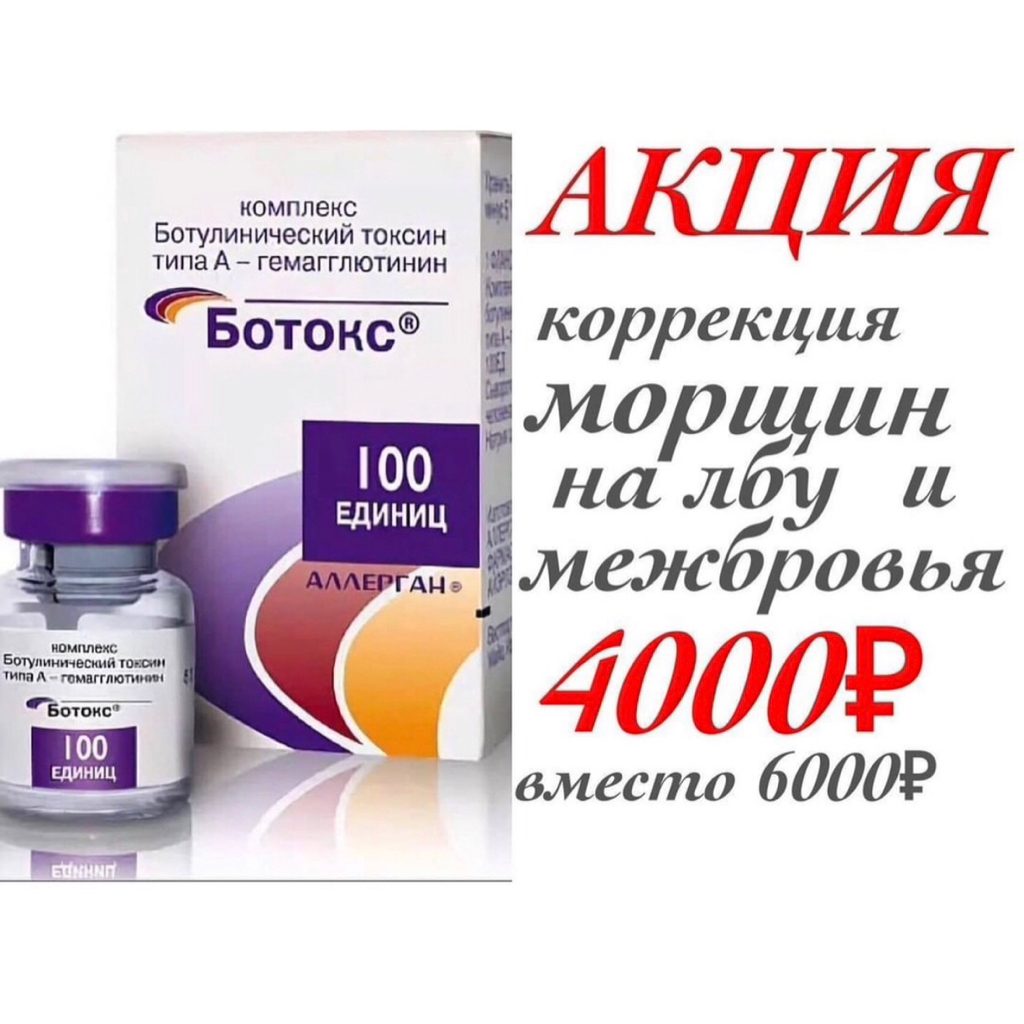 Ботулинотерапия