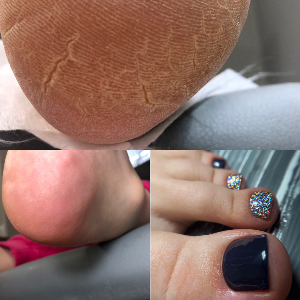 Педикюр «полный педикюр с покрытием гель лака»