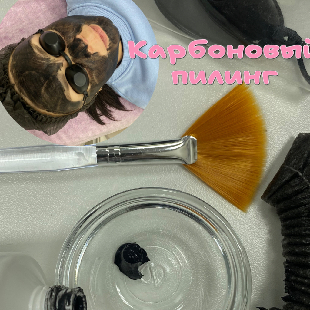 Карбоновый пилинг