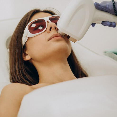 Лазерное омоложение. Лицо + декольте (шея в подарок)