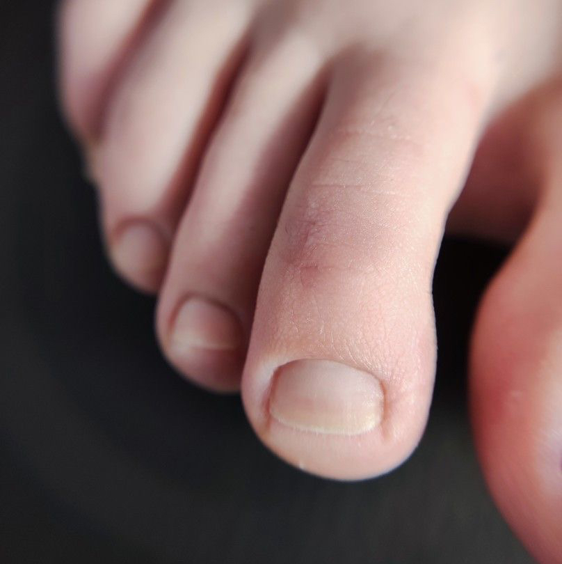 Педикюр гигиенический «Экспресс» мужской (без обработки стоп)