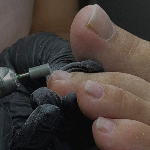 Педикюр гигиенический мужской (обработка пальчиков и стоп)