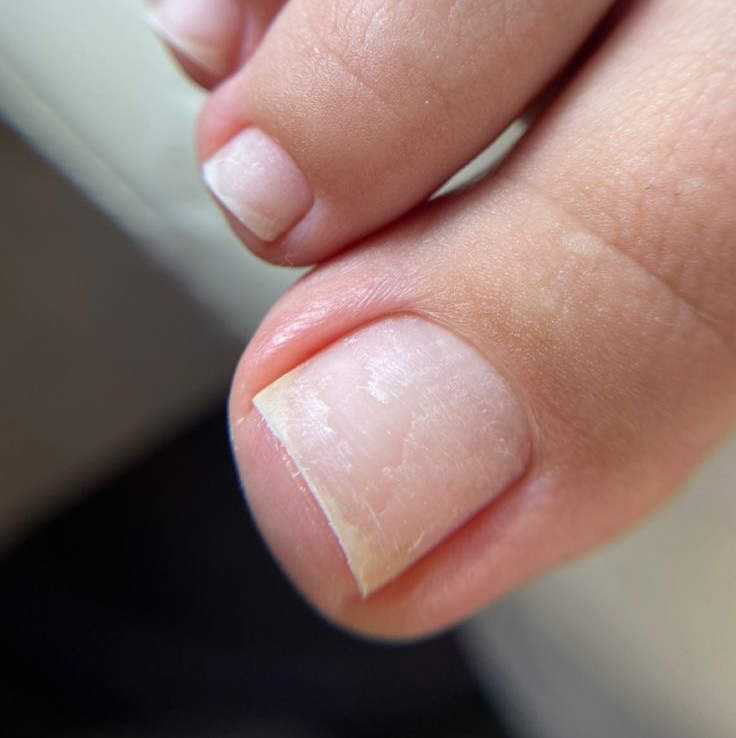 Педикюр эстетический