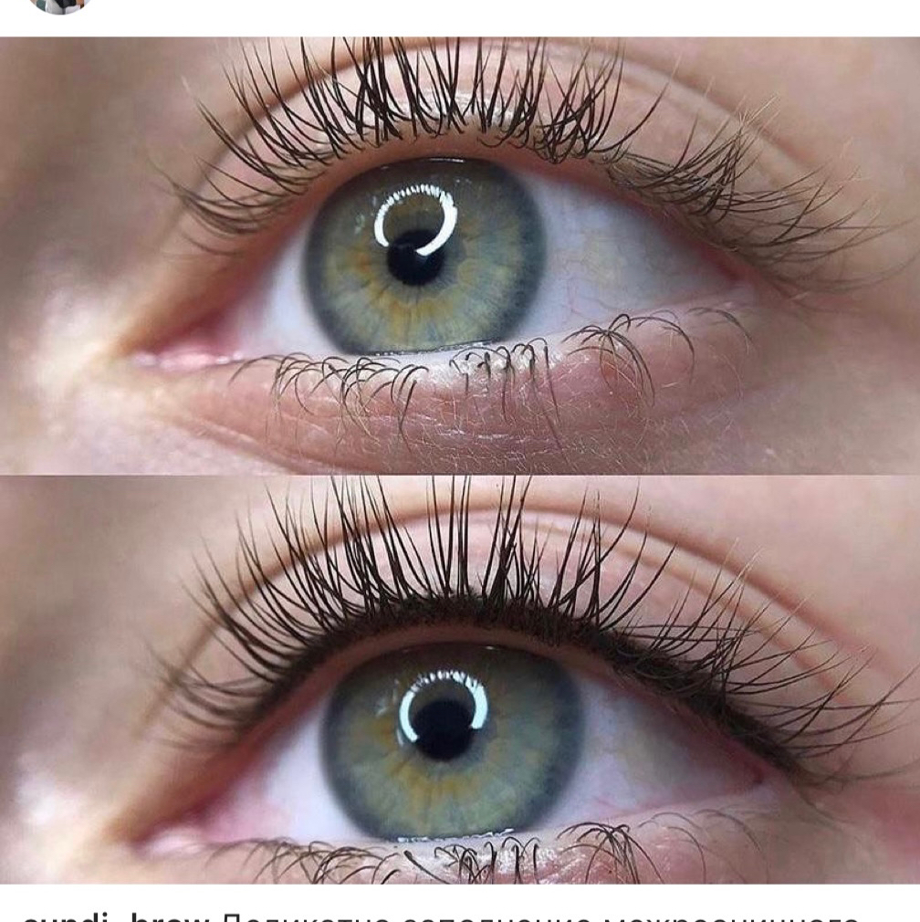 Пм межресничка