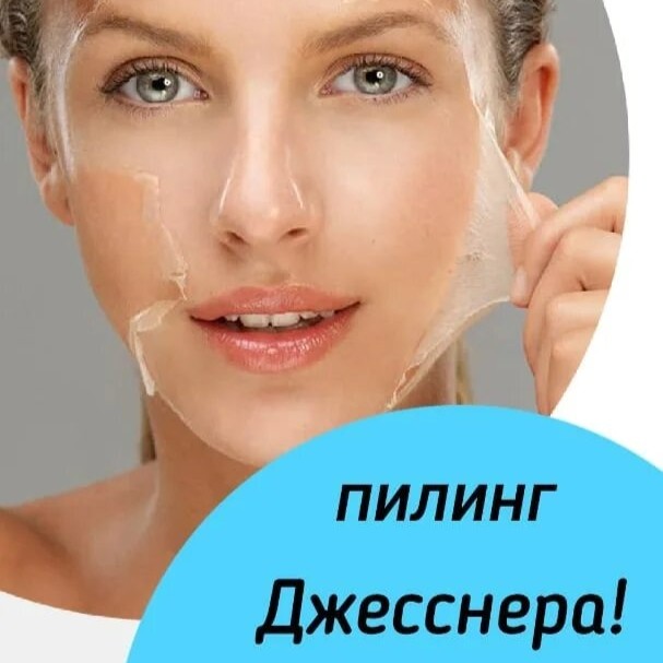 Пилинг Джесснера