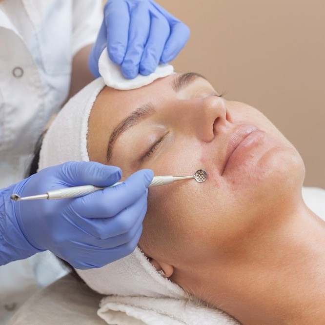 Чистка лица