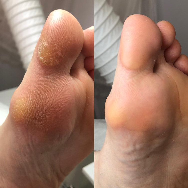 SMART педикюр  (обработка пальчиков без покрытия+крем+массаж)