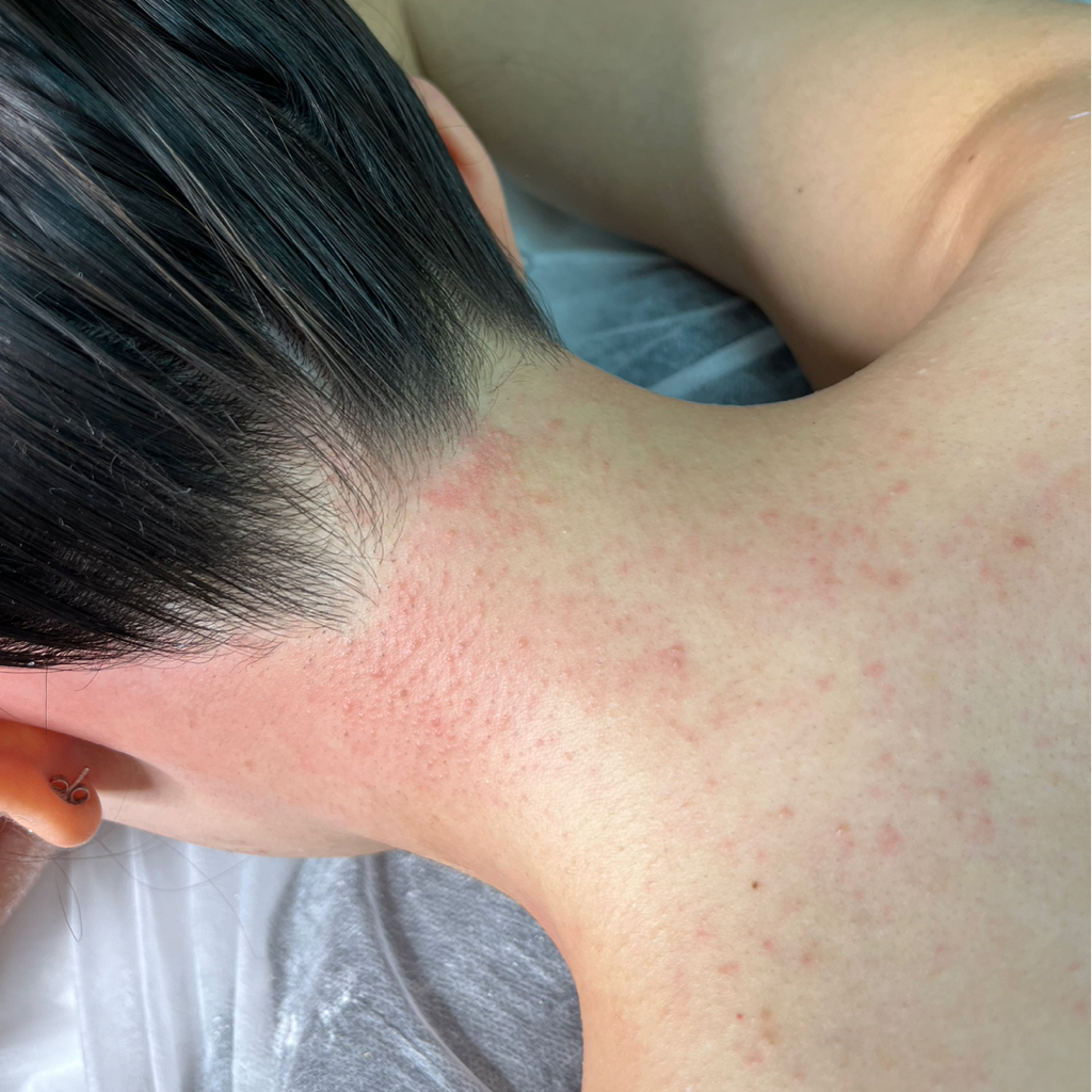 Шея и зона роста волос