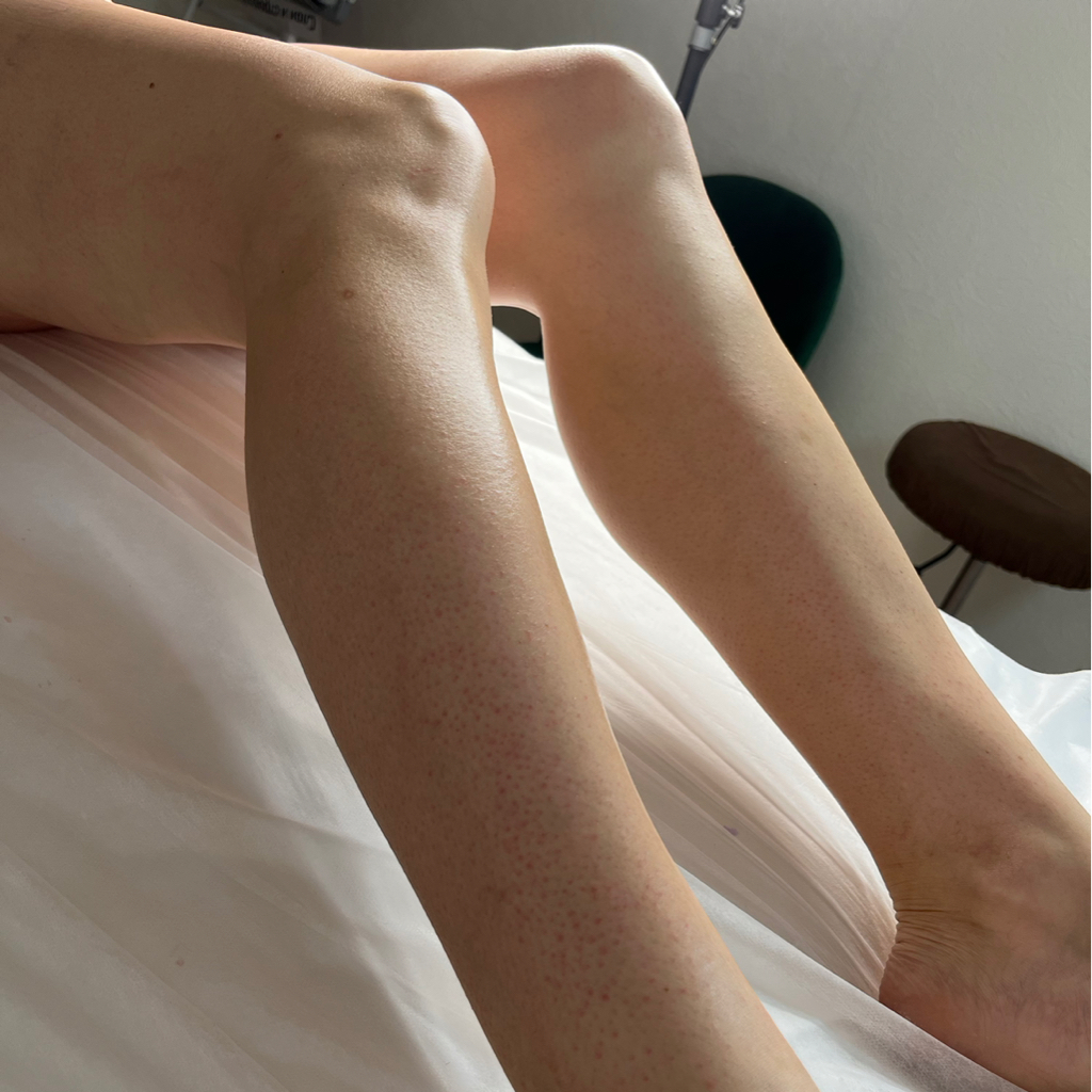 Ноги полностью