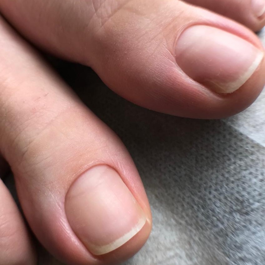 Педикюр пальчики