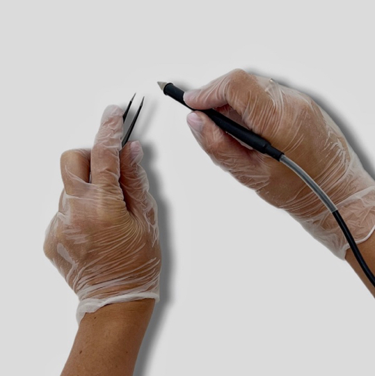 ЭлектроЭпиляция любой зоны