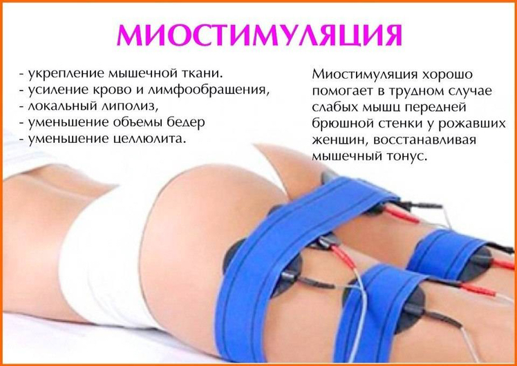 Миостимуляция (1 зона)