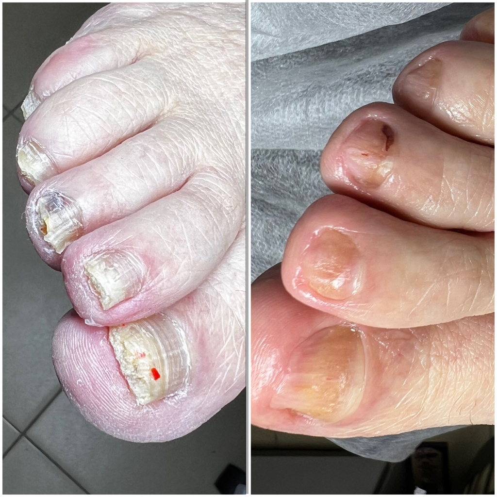 Обработка сложных ногтей