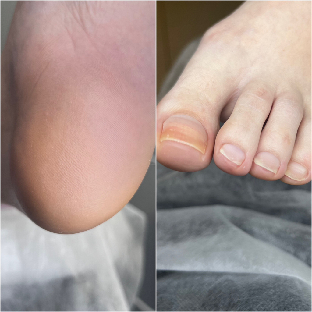 Педикюр эстетический без покрытия