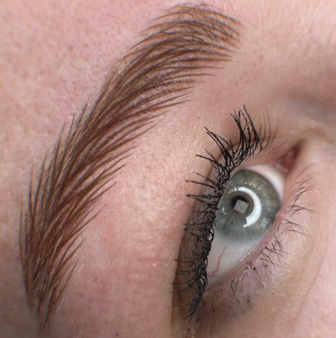 Волосковые брови