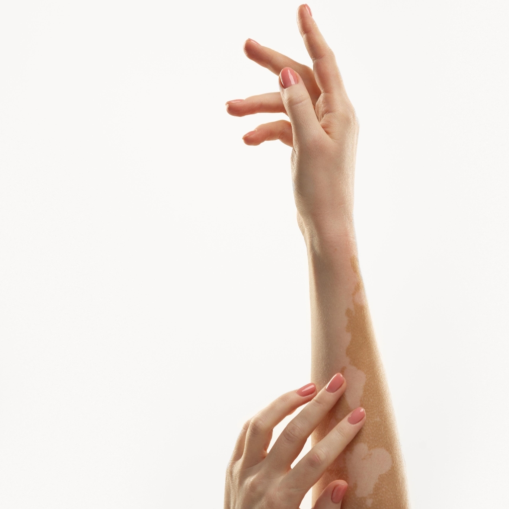 Лазерная эпиляция руки до локтя/ предплечья