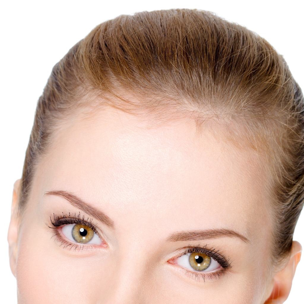 Лазерная эпиляция лоб