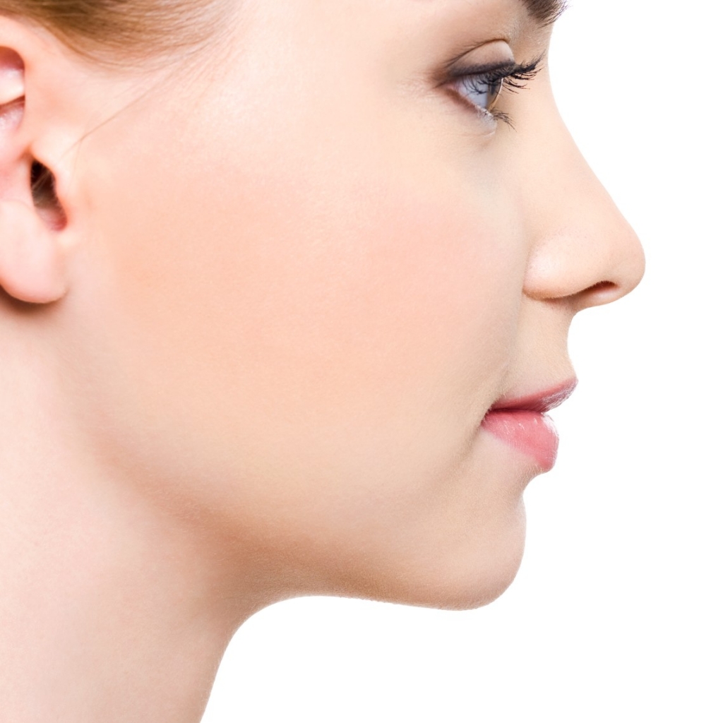 Лазерная эпиляция щеки