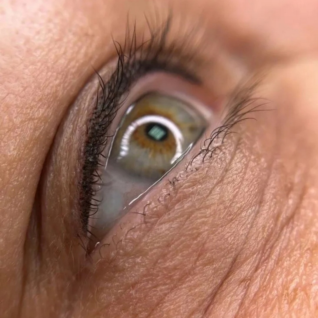 межресничка