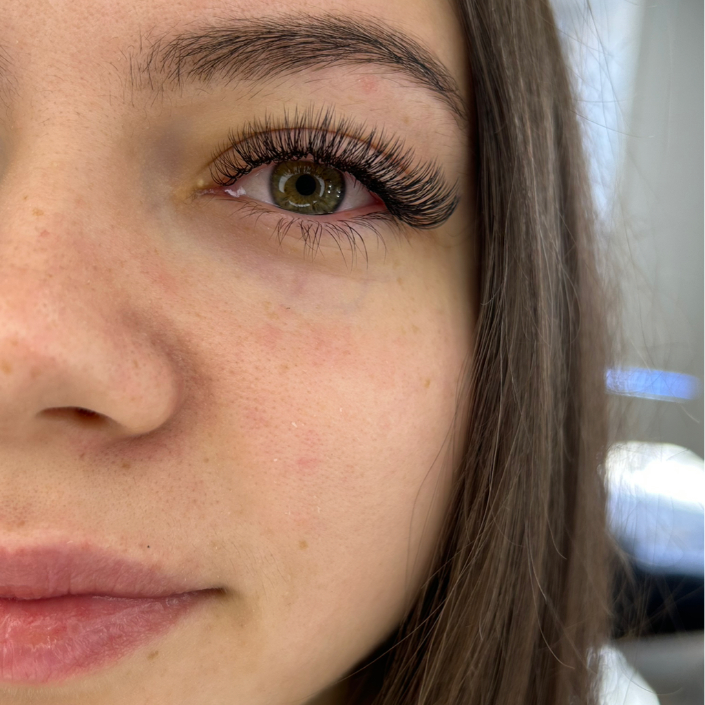 2 D объем (быстрая скорость)