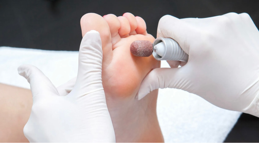 Педикюр (стопа без пальцев)  Топ-мастер