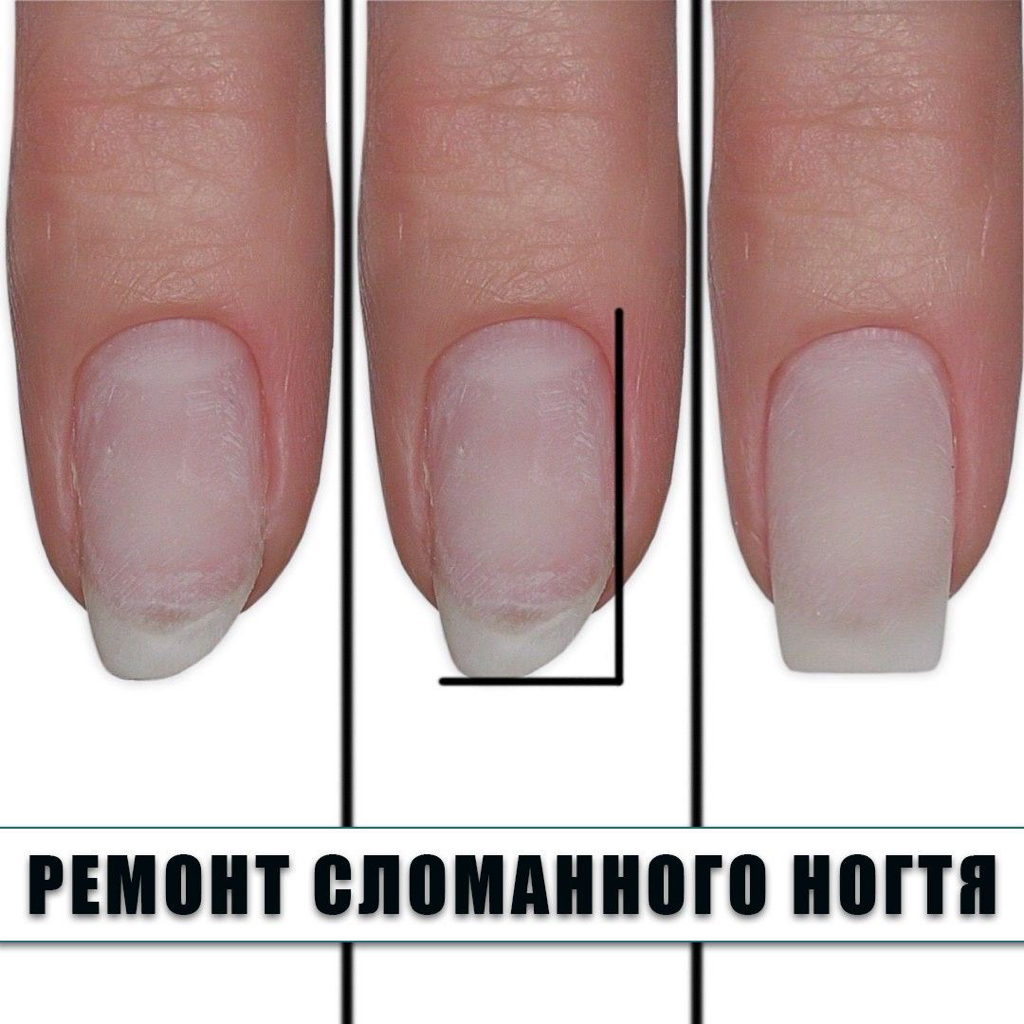 Ремонт 1 ногтя