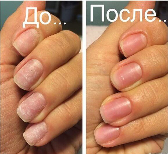 Укрепление ногтей системой IBX