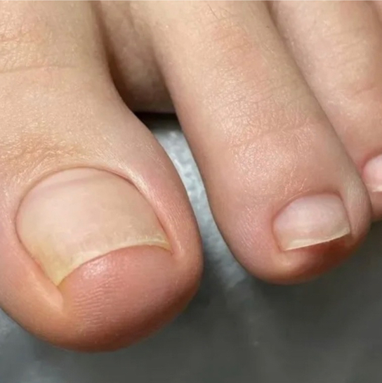 Мини педикюр(пальчики) без покрытия