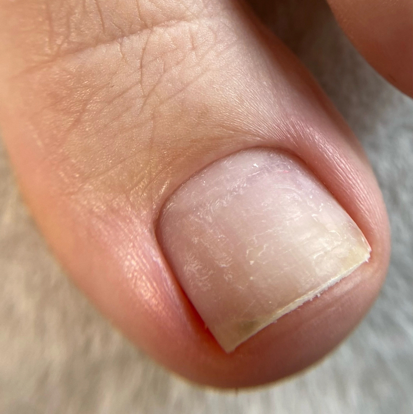 Снятие гель-лака (Ноги)