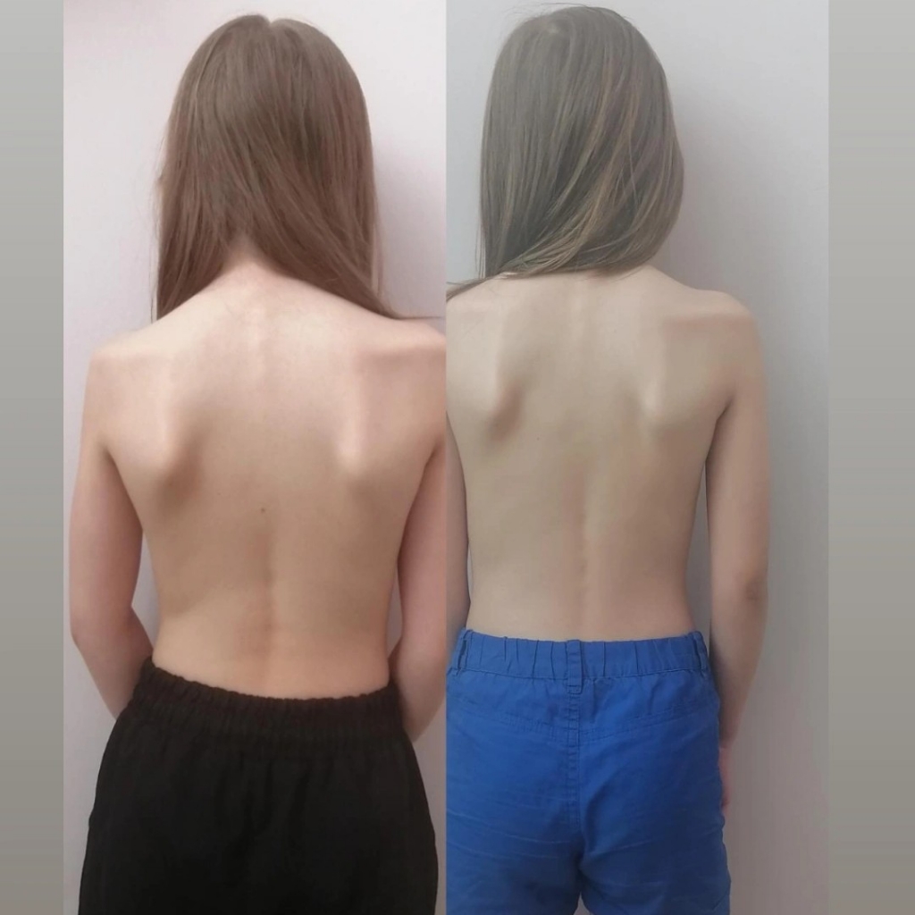 Детский массаж до 12 лет
Спина и шейно воротникая зона