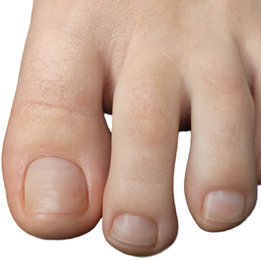 Гигиенический педикюр