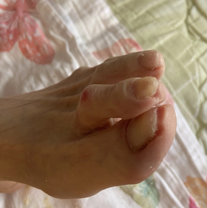 Педикюр для пенсионеров ( старость в радость)