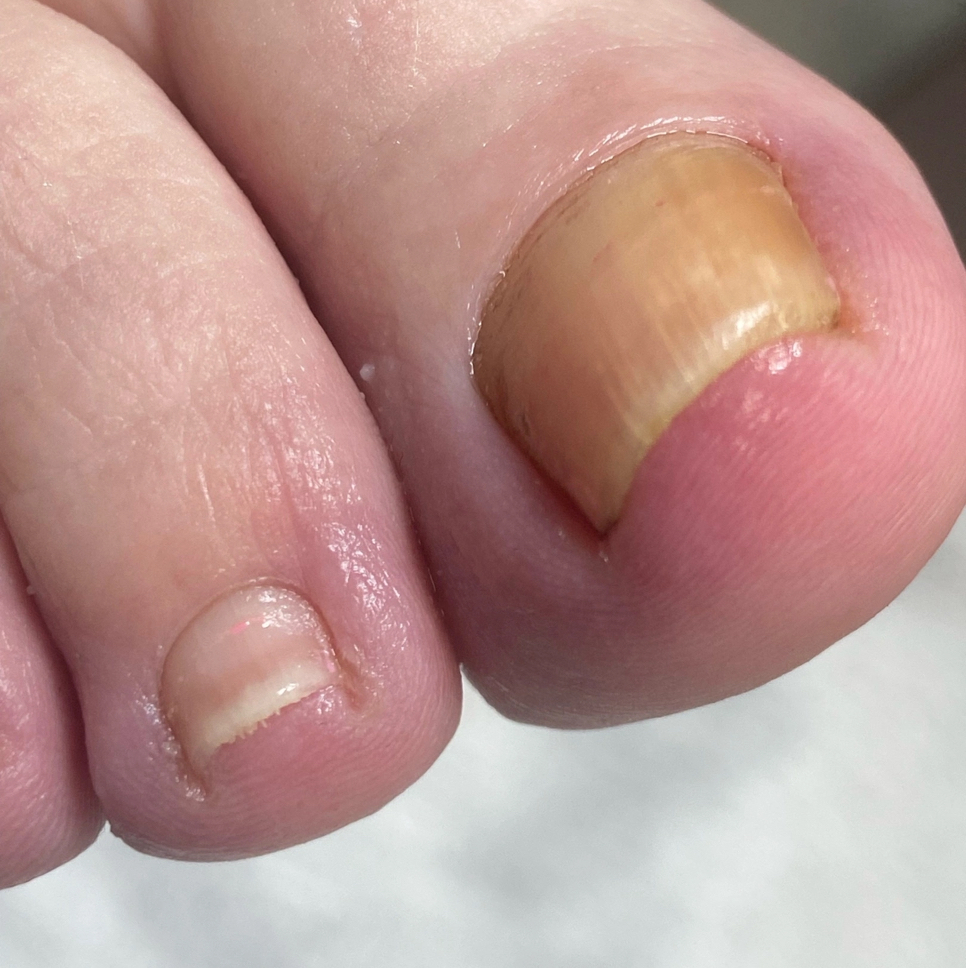 Гигиенический педикюр версия Лайт ( обработка стоп либо ногтей)