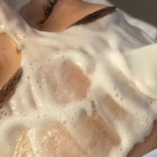 Карбокситерапия  неинвазивно