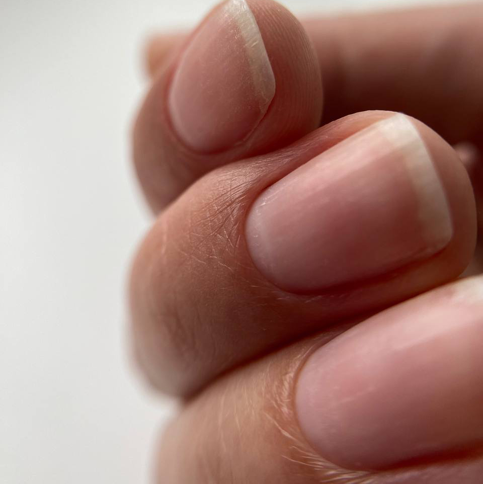 Полное снятие+опил формы