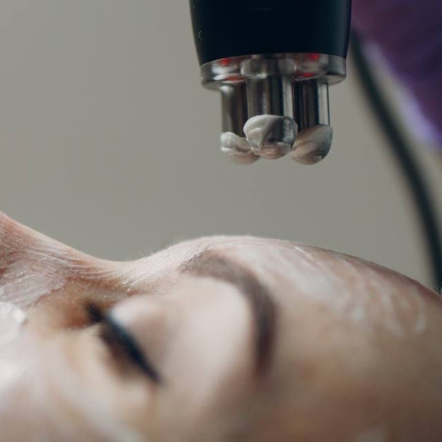 RF лифтинг (лицо + шея)