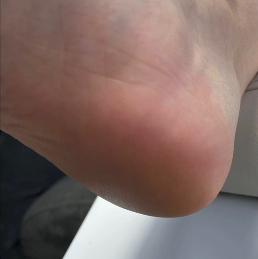 Педикюр дисками обработка стоп и пальцев без покрытия. С МАЯ ПОВЫШЕНИЕ ЦЕН