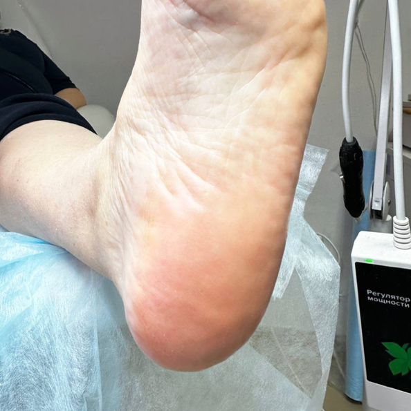 Смарт педикюр