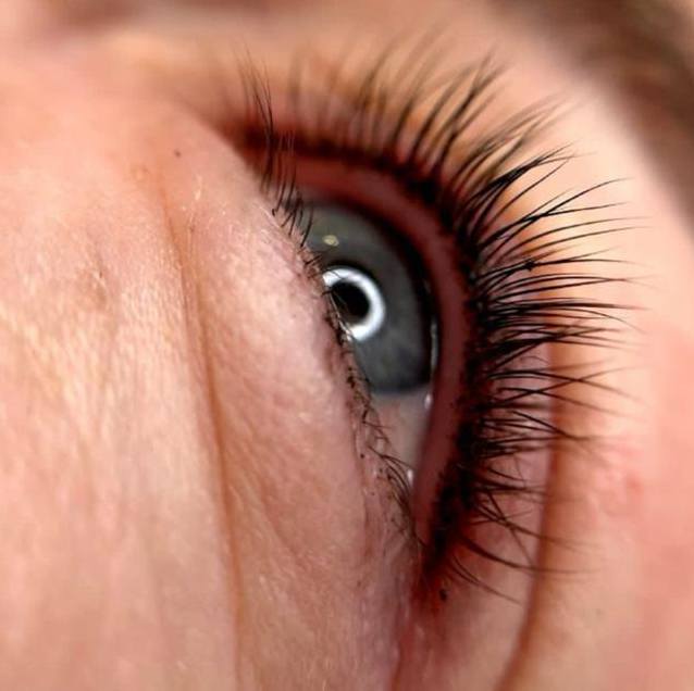 Межресничка