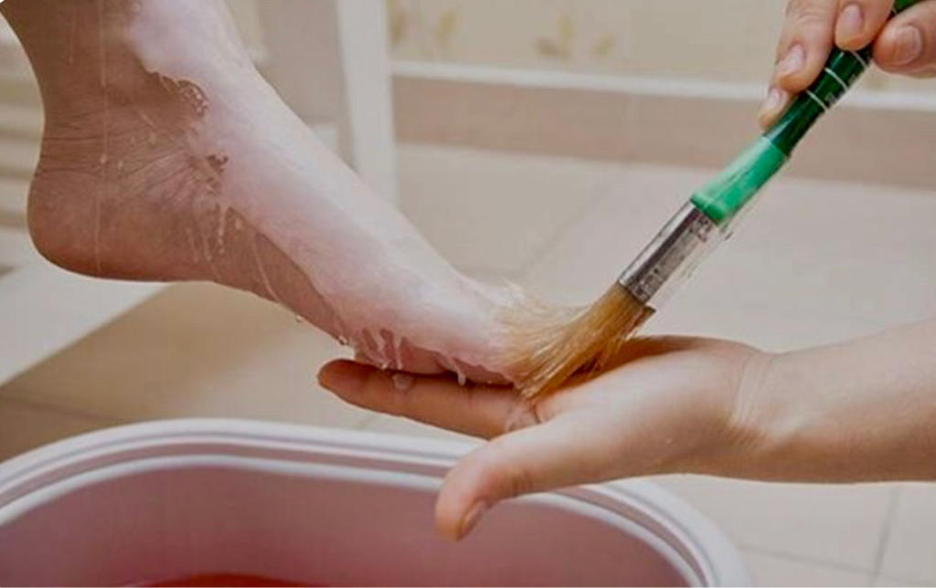 Парафинотерапия ног(горячий парафин)