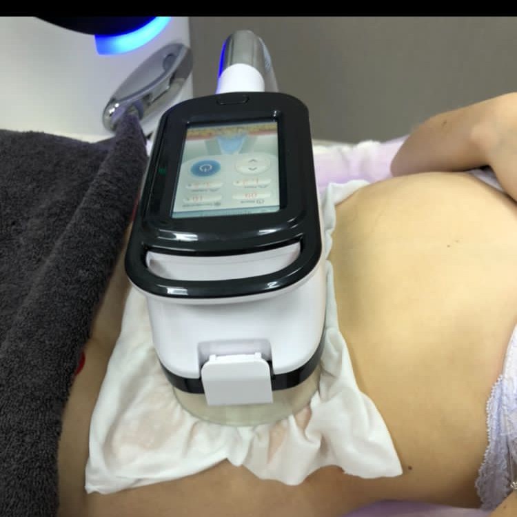 криолиполиз