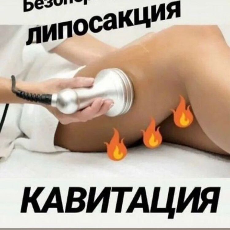 Кавитация