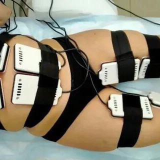 Лазерный липолиз