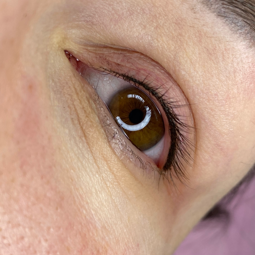 ПМ межресничка