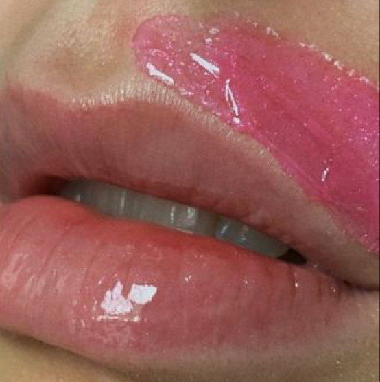 Удаление нежелательных волос на лице