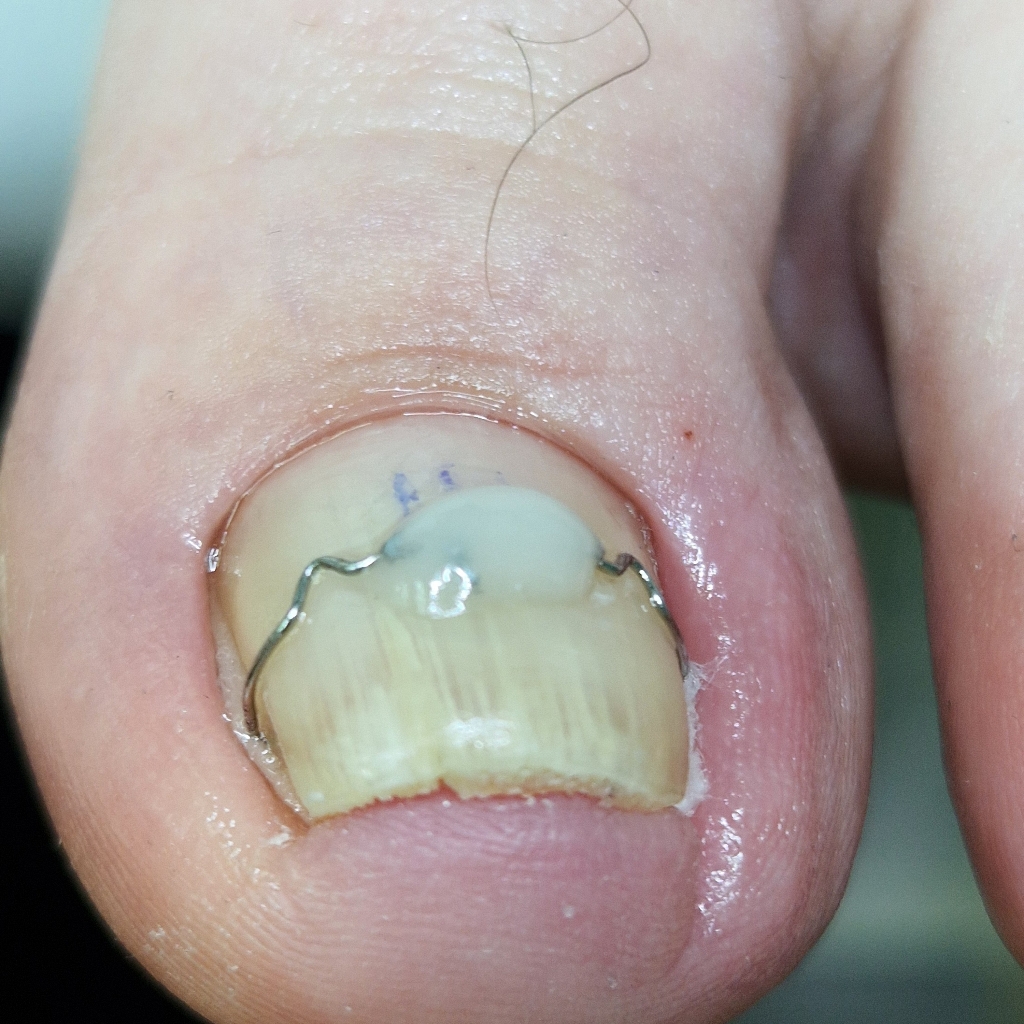 коррекционная система 3ТО