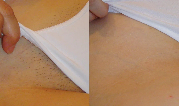 Бикини классика.