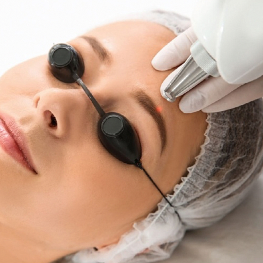 Удаление лазером перманента/тату